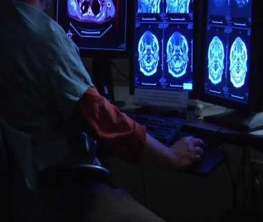 beyin taraması monitörleri izliyor radyolog