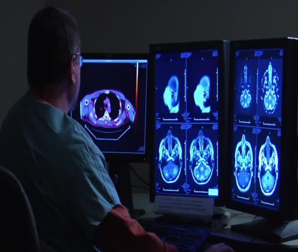 Radiólogo observando monitores de escáner cerebral — Vídeos de Stock