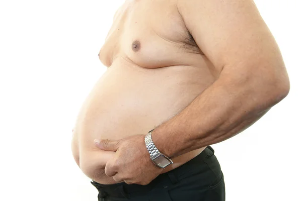 Obézní pacient — Stock fotografie