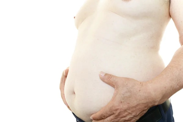 Retrato de um paciente obeso — Fotografia de Stock