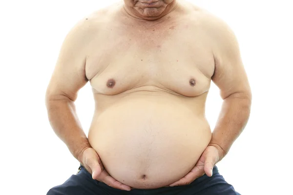 Obese patient — Stock Photo, Image