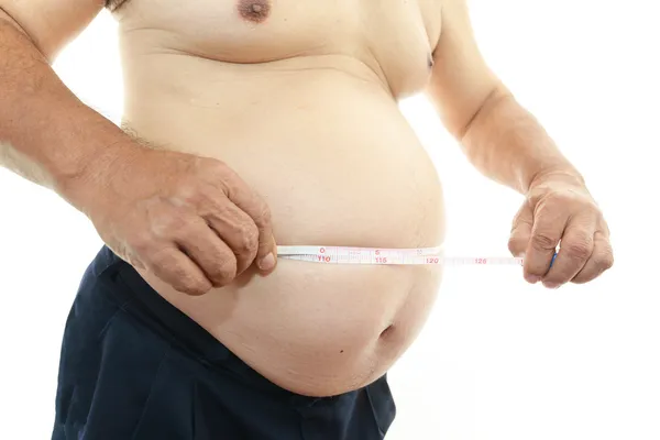 Obese patient — Stock Photo, Image