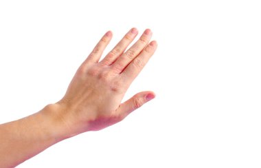 Sol bilek derisinde deri tahrişi. Yüksek kalite fotoğraf