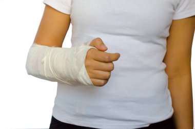 Kadın kolundaki bandaj izole edilmiş. Yüksek kalite fotoğraf