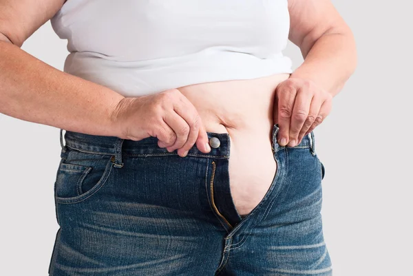 脂肪の女性 — ストック写真