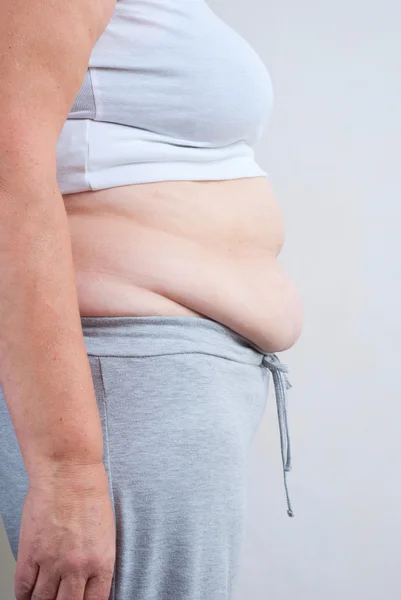 Mujer gorda — Foto de Stock