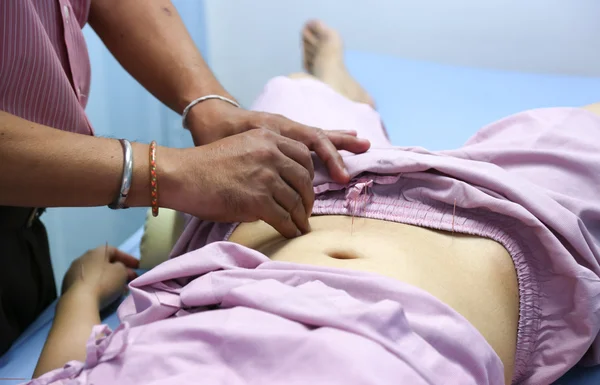 医師は、アジアの女性のための鍼治療をやっています。 — ストック写真