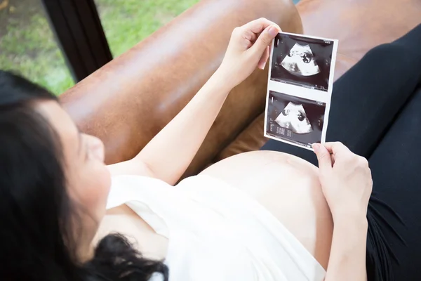 Zwangere vrouw kijken echografie foto — Stockfoto