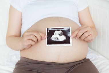 Karın ultrasonu fotoğraf