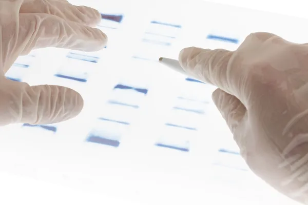 Examinar la transparencia del ADN —  Fotos de Stock