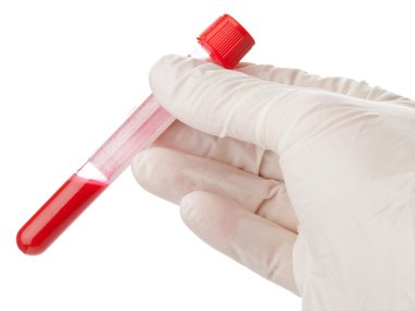 kan örneği kontrol