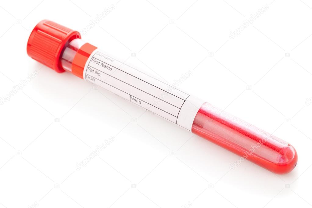 Download - Blood sample vial with blood specimen on white background - Stoc...