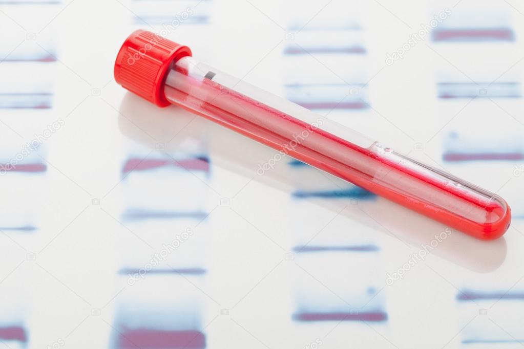 DNA blood sample