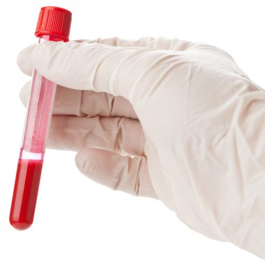 kan örneği kontrol