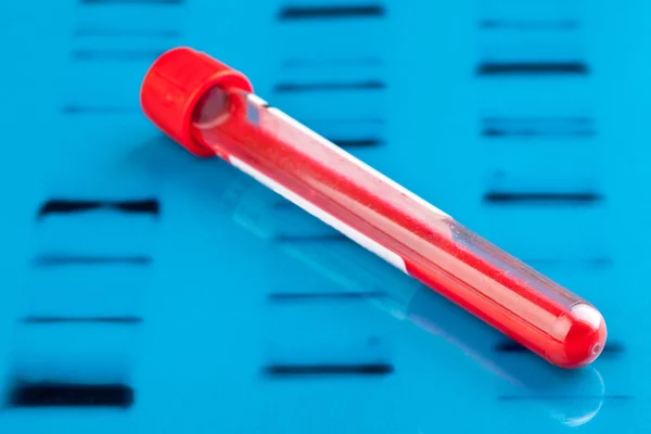 Образец крови ДНК — стоковое фото