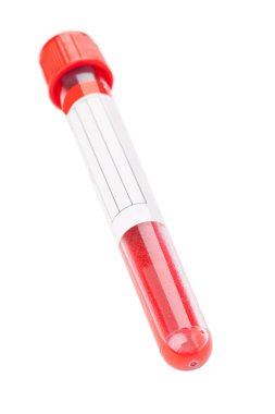 kan örneği test tüpü