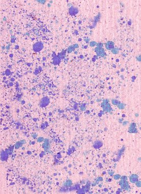 pembe mavi lekeler ve damla