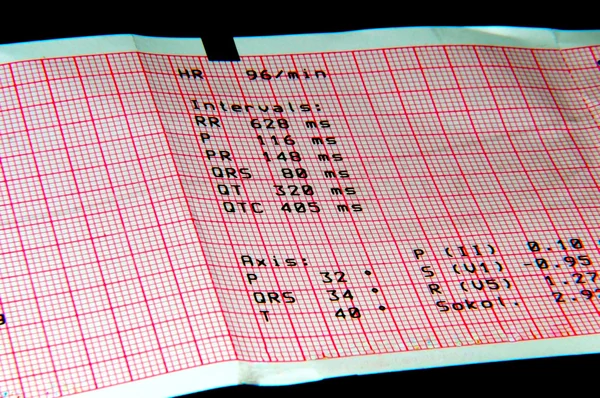 Диагностический лист ЭКГ — стоковое фото