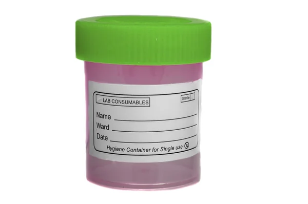 Sample collection container — Stock Photo, Image