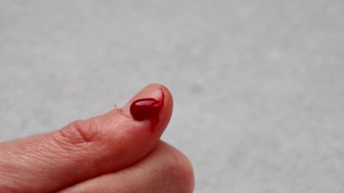 bir yandan kesim başparmak