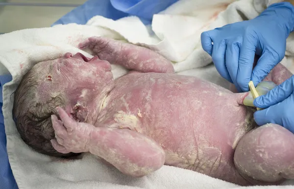 New born baby girl with clamped umbilical cord — Stock Photo, Image