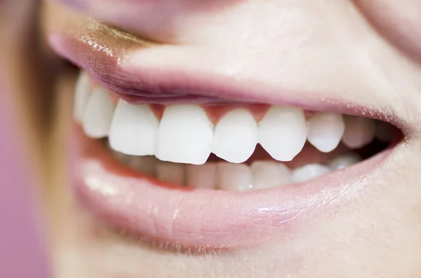Красивые зубы улыбаются — стоковое фото
