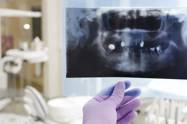 Dental — Stock Photo, Image