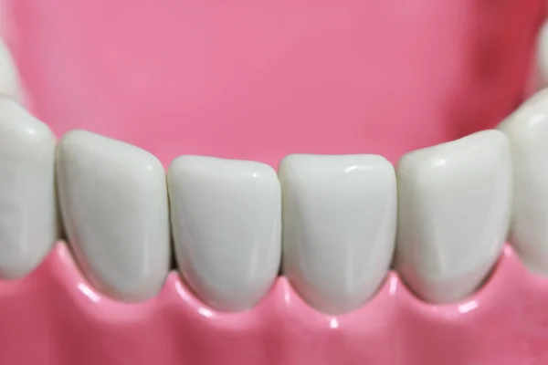 Dentes de plástico e modelo de goma — Fotografia de Stock