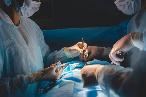 Une équipe internationale de médecins effectue une opération chirurgicale complexe sur un patient sous anesthésie. Une salle d'opération moderne et des chirurgiens expérimentés sauvent des vies — Photo