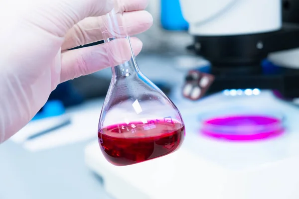 Frasco redondo con líquido de color o muestra de sangre en mano científica en guantes de goma en un laboratorio moderno con un microscopio en el fondo — Foto de Stock