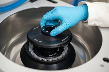 Lastik eldivenli kadın laboratuar teknisyeni santrifüj doldurup kapağı kapatıyor.. 