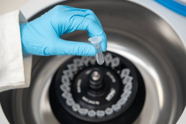 Bilim adamı mikro santrifüj tüplerini faz ayrımı için santrifüje koydu 