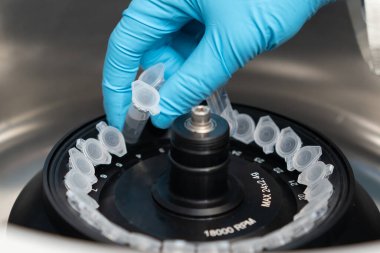 Bilim adamı mikro santrifüj tüplerini faz ayrımı için santrifüje koydu 