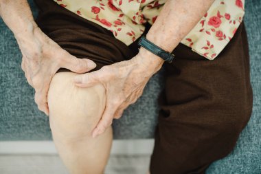 Asian elder woman having a critical health problem at knee and bone joint, woman touching or holding at knee. Elder woman getting hurt and injured at her leg.