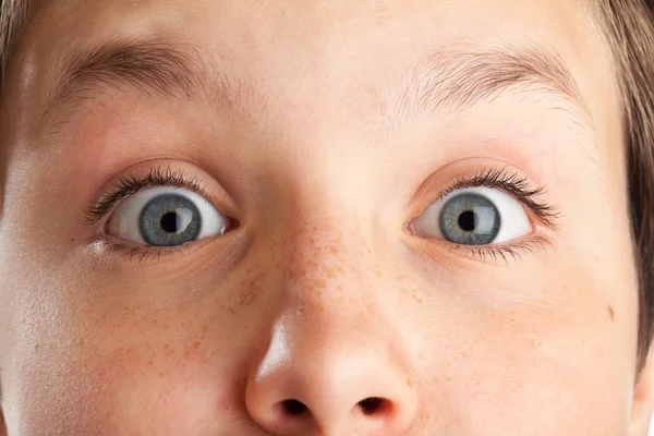 Teenage boy (Causian), closeup on surprised face — Stock Photo, Image