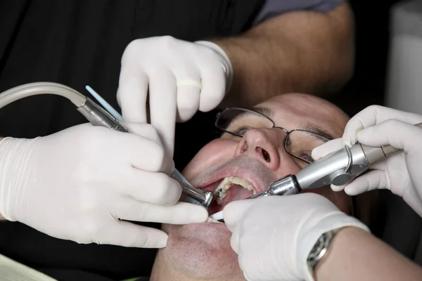 Mann bekommt beim Zahnarzt einen Zahn gefüllt — Stockfoto