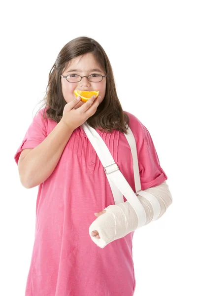 Gesunde Ernährung. Kaukasisches kleines Mädchen mit gebrochenem Arm isst eine frische Orange — Stockfoto