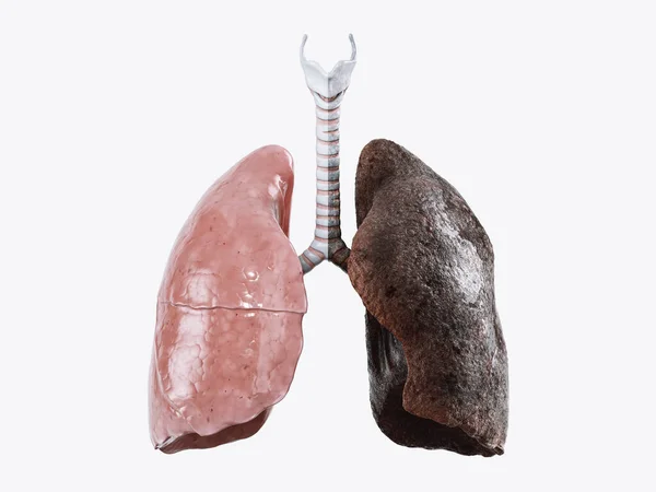 Ilustración Realista Pulmones Humanos Sanos Frente Pulmones Fumadores Aislados Sobre —  Fotos de Stock