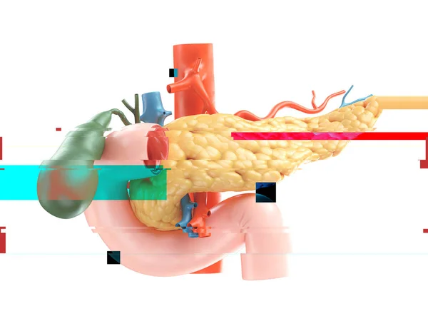 Realistic 3d illustration of anatomical model of human pancreas, duodenum and gall bladder with glitch effect, failure concept