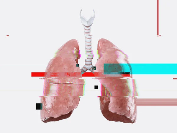 Realistic Illustration Anatomical Model Human Lungs Glitch Effect Failure Disease — Stock Photo, Image