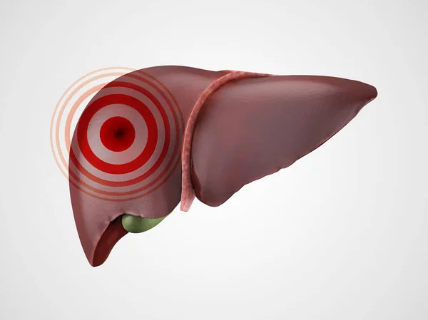 人間の肝臓の病気や痛みの概念は それに赤い痛みの兆候と白に隔離されます 3Dイラスト — ストック写真