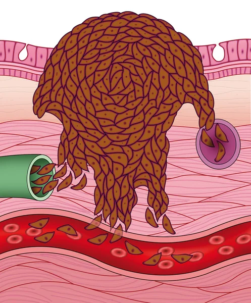 Cancerigenic 셀 스톡 사진