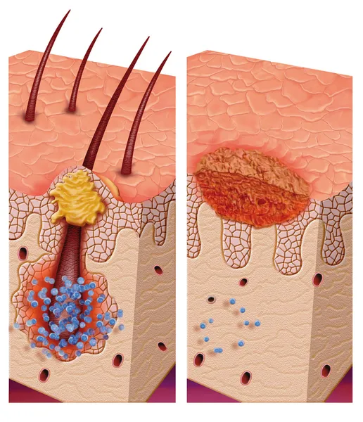 Pathogenic bacteria — Stock Photo, Image