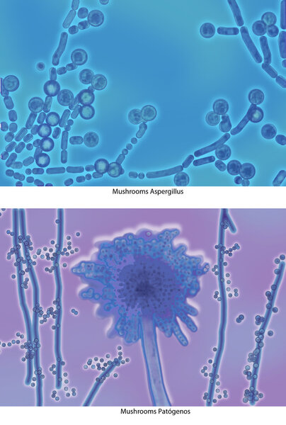 Aspergillus PatAgenos