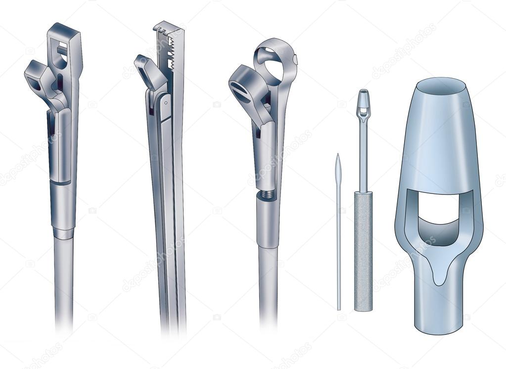 gynécologie instruments — Photographie Alexilus © 21672851