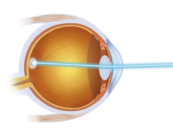 Laser treatment on the eye — Stock Photo, Image
