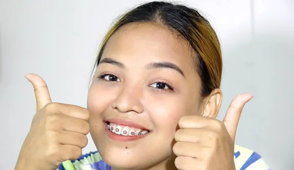 Joven Asiática Mujer Con Frenos Pulgares Hasta — Foto de Stock
