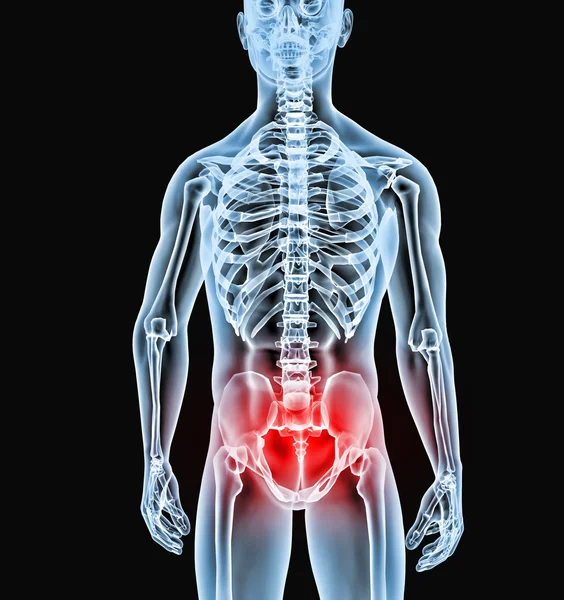 Röntgenbild Körperteil — Stockfoto