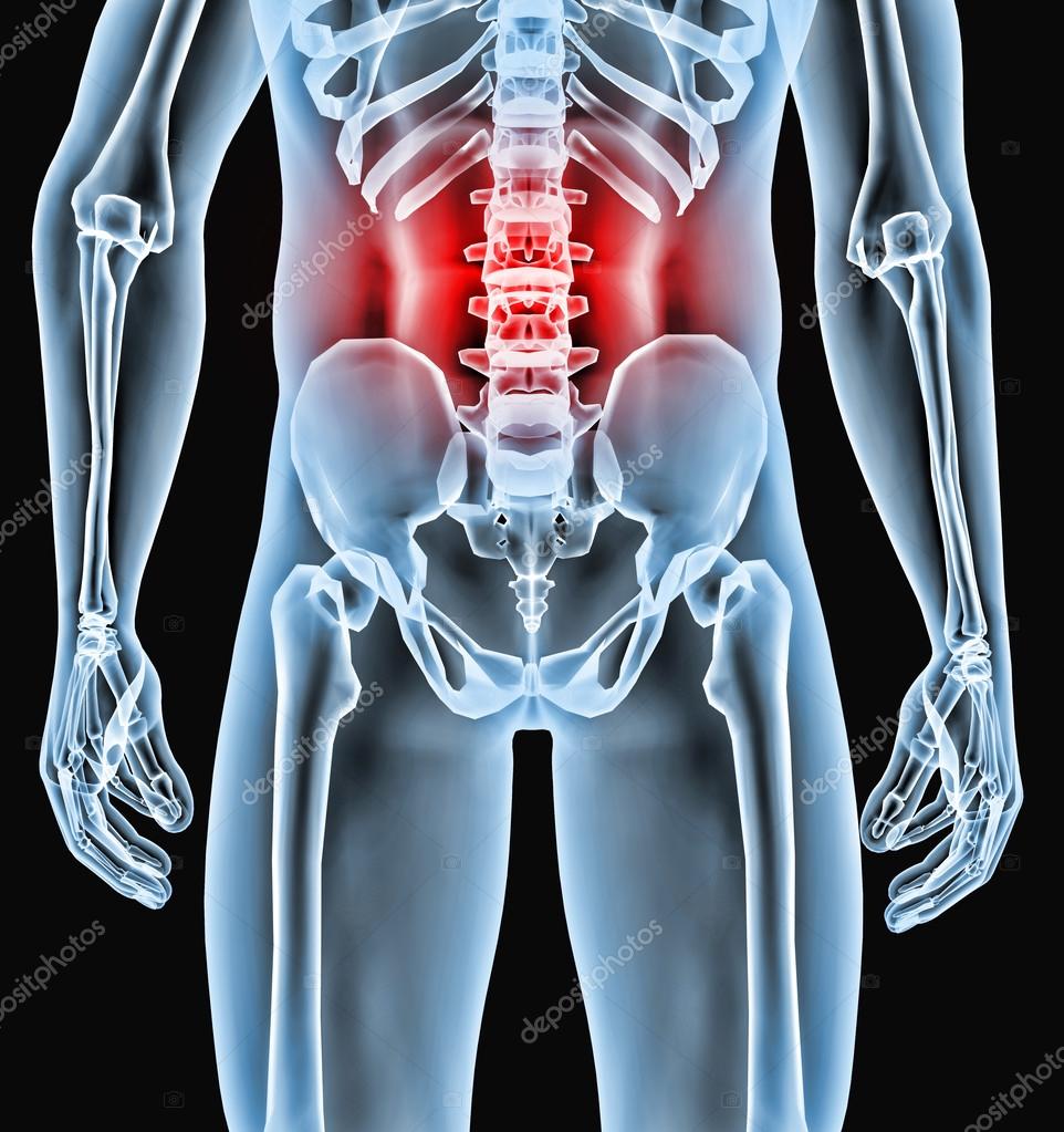 Radiography body part — Stock Photo © Giovanni_Cancemi 21671215