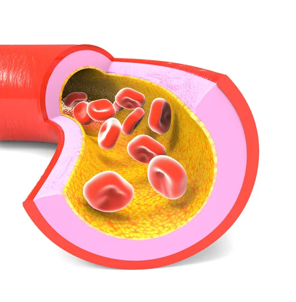 Kırmızı kan hücreleri ile normal arter — Stok fotoğraf